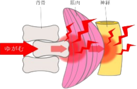 痛みの原因のイメージ画像